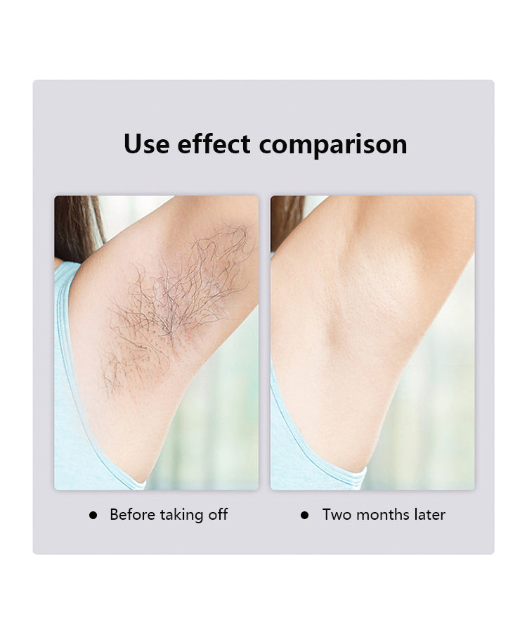 Hair Removal for Womens
